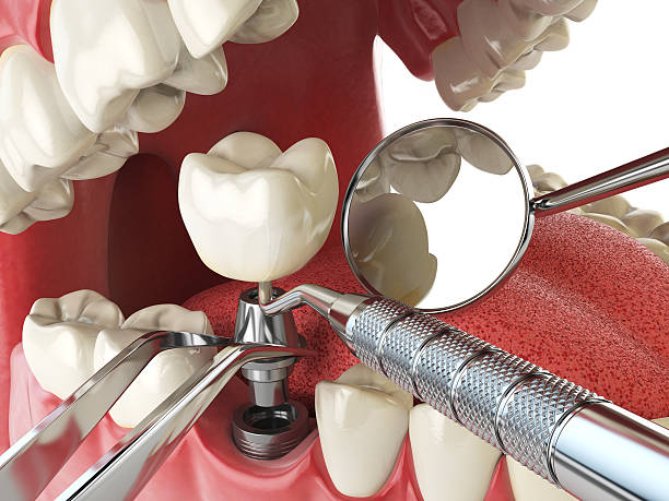 Best Emergency Tooth Extraction in Mcgregor, FL