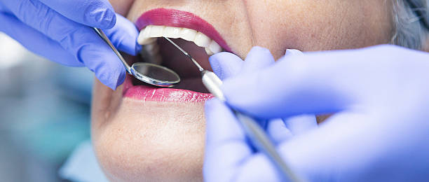 Best Emergency Tooth Extraction in Mcgregor, FL